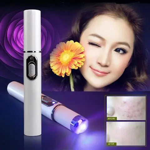 Blue Light Therapy Acne Laser Pen Soft Scar Wrinkle Removal Treatment Device Skin Care Beauty Equipment eprolo