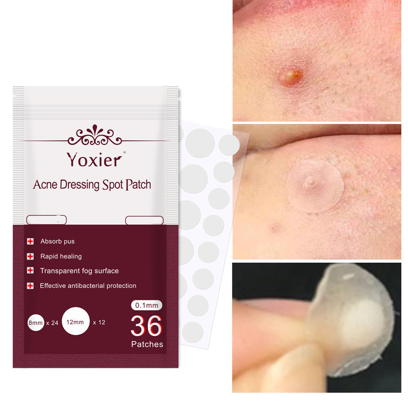 Invisible Acne Patch Set – Spot Treatment, Pimple Remover Stickers & Face Cream for Blemish-Free Skin - Kreative